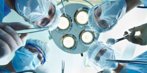 four surgeons looking down